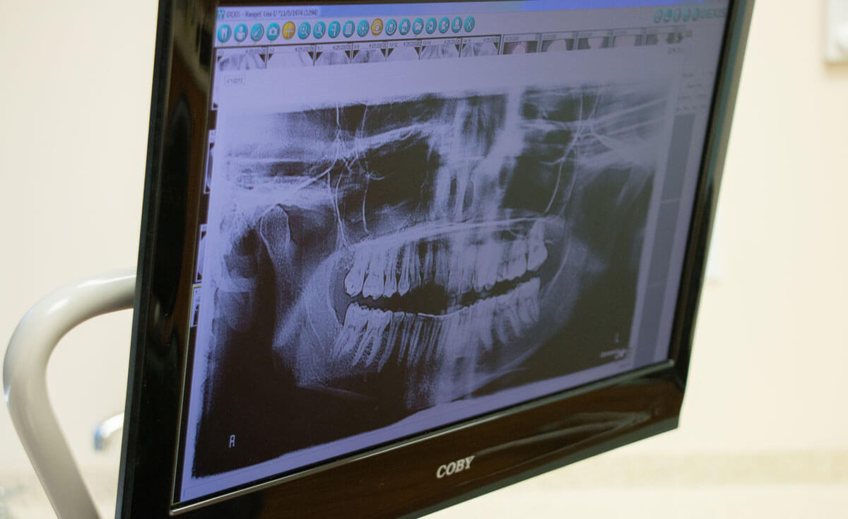 Cone Beam Scanner or Patient