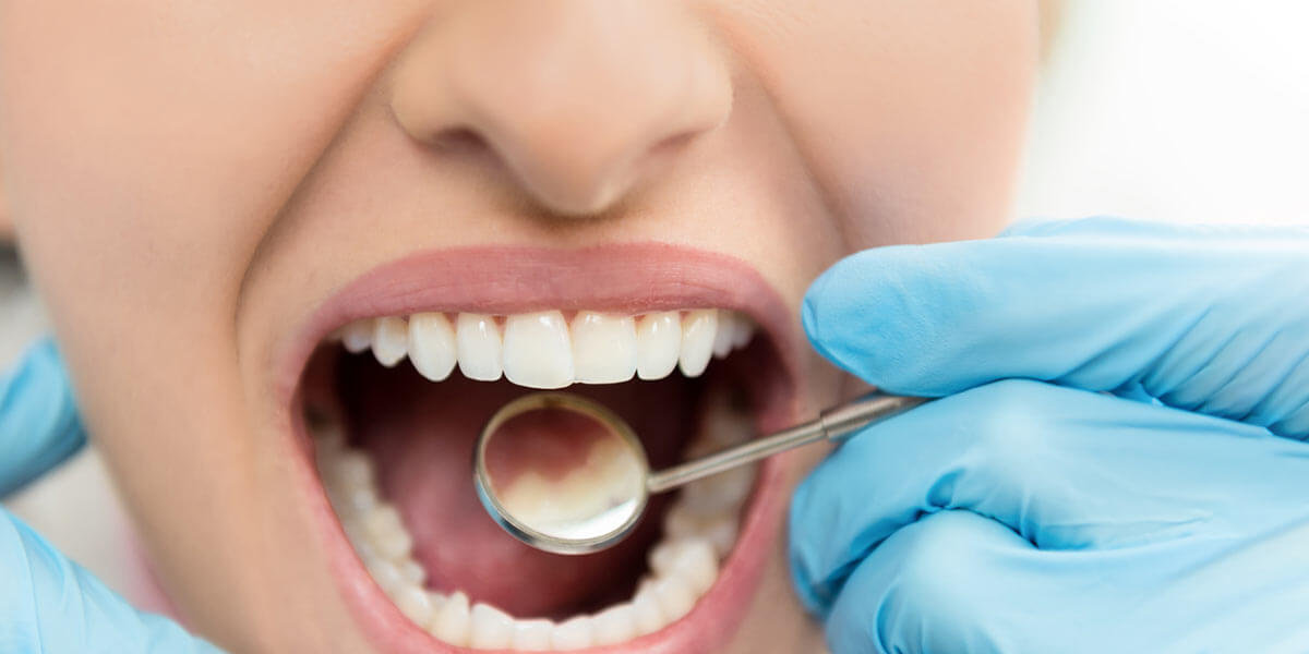 Dental exam on woman with nice teeth.