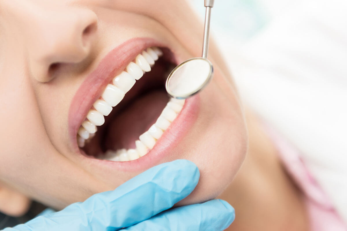 dentist patient with their mouth open during exam