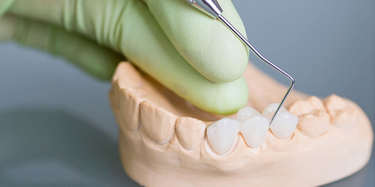 dentist working on a dental bridge